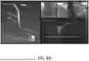 Fig. 14 - THREE-DIMENSIONAL SIZING TOOL FOR CARDIAC ASSESSMENT