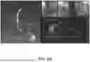 Fig. 15 - THREE-DIMENSIONAL SIZING TOOL FOR CARDIAC ASSESSMENT