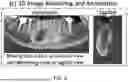 Fig. 09 - MANDIBULAR CANAL DETECTION