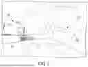 Fig. 02 - Systems and Methods for Percutaneous Spinal Interbody Fusion (PSIF)