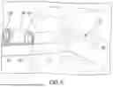 Fig. 06 - Systems and Methods for Percutaneous Spinal Interbody Fusion (PSIF)