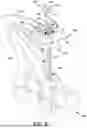 Fig. 09 - LATERAL RETRACTOR SYSTEM FOR MINIMIZING MUSCLE DAMAGE IN SPINAL SURGERY