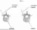 Fig. 02 - PEDICLE BASED RETRACTOR WITH SCREW GATE