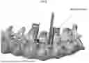 Fig. 09 - PEDICLE BASED RETRACTOR WITH SCREW GATE