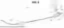 Fig. 09 - Devices and Method for Blood Vessel Occlusion