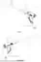 Fig. 03 - Suction Endoscopic Sheath and Assembly with Transposed Pressure Regulating Mechanism