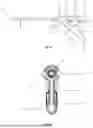 Fig. 05 - Suction Endoscopic Sheath and Assembly with Transposed Pressure Regulating Mechanism