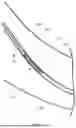Fig. 06 - SYSTEMS AND METHODS FOR REMOVING A HYDROGEL IMPLANT FROM A BODY LUMEN