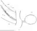 Fig. 08 - SYSTEMS AND METHODS FOR REMOVING A HYDROGEL IMPLANT FROM A BODY LUMEN