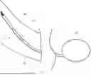 Fig. 09 - SYSTEMS AND METHODS FOR REMOVING A HYDROGEL IMPLANT FROM A BODY LUMEN