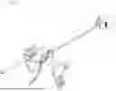 Fig. 02 - Surgical Staple or Anchor System