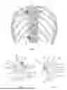 Fig. 02 - BONE HOOK APPARATUS