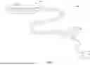 Fig. 02 - LITHOTRIPSY BALLOON CATHETER