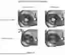 Fig. 07 - Systems and Methods for Anatomical and Device Optimization