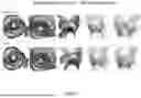 Fig. 08 - Systems and Methods for Anatomical and Device Optimization