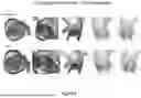 Fig. 09 - Systems and Methods for Anatomical and Device Optimization