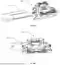 Fig. 149 - IMPLANT EXPANDING IN WIDTH BEFORE HEIGHT USING A SINGLE ACTUATOR