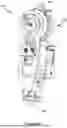 Fig. 03 - SWING DYNAMICS OF A PROSTHETIC OR ORTHOTIC DEVICE
