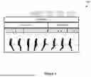 Fig. 07 - SWING DYNAMICS OF A PROSTHETIC OR ORTHOTIC DEVICE
