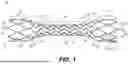 Fig. 02 - METHODS AND SYSTEMS FOR AN INTRACRANIAL STENT