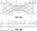 Fig. 06 - METHODS AND SYSTEMS FOR AN INTRACRANIAL STENT