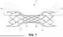 Fig. 08 - METHODS AND SYSTEMS FOR AN INTRACRANIAL STENT