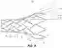 Fig. 09 - METHODS AND SYSTEMS FOR AN INTRACRANIAL STENT