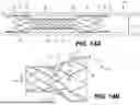 Fig. 16 - METHODS AND SYSTEMS FOR AN INTRACRANIAL STENT