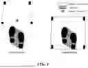 Fig. 07 - ROBOTIC WALKER FOR GAIT AND POSTURAL STABILITY ASSISTANCE WITH A HIGH LEVEL OF AUTONOMY AND SAFETY
