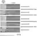 Fig. 05 - METHOD OF REDUCING CST FLUCTUATION IN NEOVASCULAR AMD BY A RECOMBINANT ADENO-ASSOCIATED VIRUS