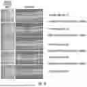 Fig. 07 - METHOD OF REDUCING CST FLUCTUATION IN NEOVASCULAR AMD BY A RECOMBINANT ADENO-ASSOCIATED VIRUS