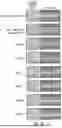 Fig. 12 - METHOD OF REDUCING CST FLUCTUATION IN NEOVASCULAR AMD BY A RECOMBINANT ADENO-ASSOCIATED VIRUS
