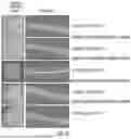 Fig. 13 - METHOD OF REDUCING CST FLUCTUATION IN NEOVASCULAR AMD BY A RECOMBINANT ADENO-ASSOCIATED VIRUS