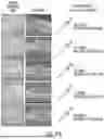 Fig. 44 - METHOD OF REDUCING CST FLUCTUATION IN NEOVASCULAR AMD BY A RECOMBINANT ADENO-ASSOCIATED VIRUS