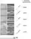 Fig. 58 - METHOD OF REDUCING CST FLUCTUATION IN NEOVASCULAR AMD BY A RECOMBINANT ADENO-ASSOCIATED VIRUS
