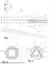 Fig. 02 - A Catheter For Placement In A Ventricular System