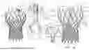 Fig. 02 - PROSTHETIC VALVE PACING SYSTEMS