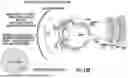 Fig. 65 - OCULAR PHOTO-BIO-STIMULATION