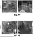 Fig. 05 - FLUID FILTRATION MEMBRANES
