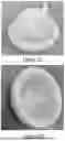Fig. 03 - METHOD FOR MAKING PROSTHETIC DEVICE