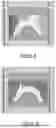 Fig. 05 - METHOD FOR MAKING PROSTHETIC DEVICE