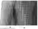 Fig. 01 - MULTI-ZONE THERMOFORMED SEAMLESS KNITTED TEXTILE PANEL