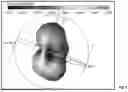 Fig. 09 - ANTENNA ARCHITECTURES FOR TEMPLE OF AR CAPABLE WEARABLE DEVICES