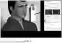 Fig. 02 - OPHTHALOMOSCOPE APPLICATION