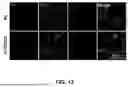 Fig. 12 - UQCC2-BASED COMPUTER-ASSISTED METHOD, SYSTEM, AND DEVICE FOR DIAGNOSING OSIMERTINIB-RESISTANT LUNG CANCER, PREDICTING DRUG THERAPEUTIC EFFECTS, AND SCREENING DRUGS TARGETED FOR OSIMERTINIB-RESISTANT LUNG CANCER