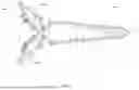 Fig. 10 - FACET JOINT FIXATION DEVICE