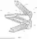 Fig. 12 - FACET JOINT FIXATION DEVICE