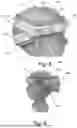 Fig. 08 - CRANIAL ORTHOSIS AND METHOD THEREFOR
