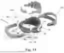 Fig. 11 - CRANIAL ORTHOSIS AND METHOD THEREFOR