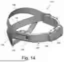 Fig. 15 - CRANIAL ORTHOSIS AND METHOD THEREFOR